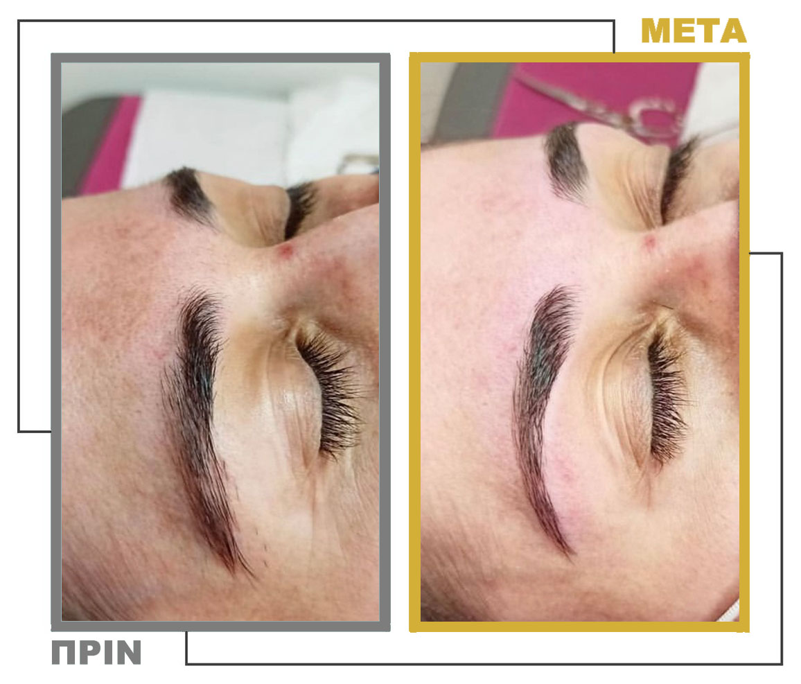 Νυφικό_Μακιγιάζ_Μεσοθεραπεία_nifiko_makigiaz_mesotherapia_20230125_155556