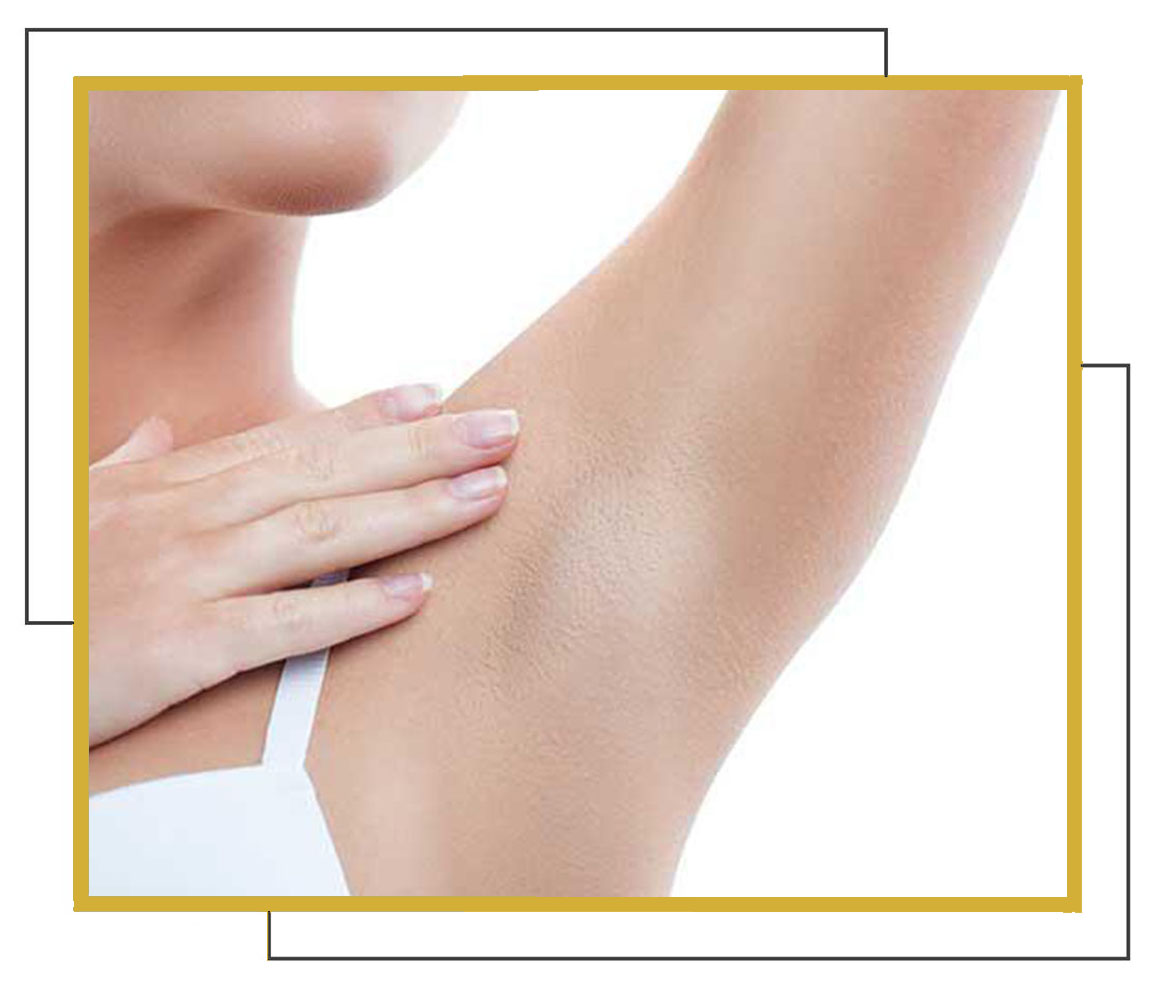 Αποτρίχωση (με κερί)